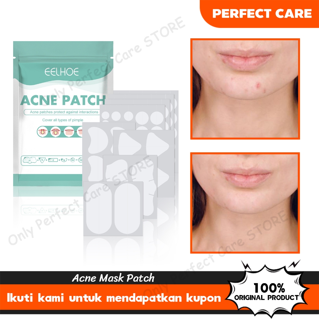 Eelhoe acne patch